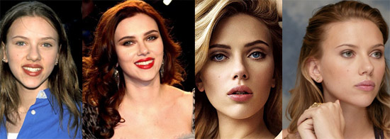 johansson before and after